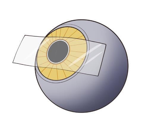 1736134236965825.jpg 人工晶体3.jpg