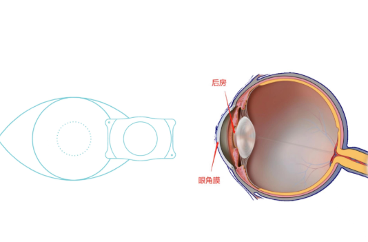 1736251409145784.jpg 晶体植入4.jpg